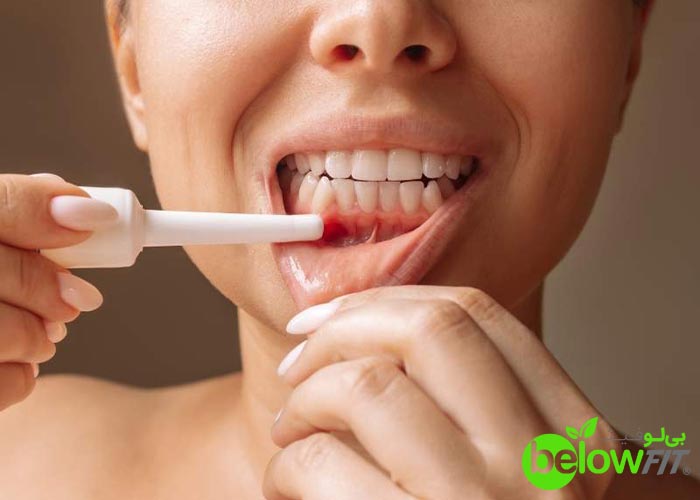 تأثیر مصرف شکر بر سلامت لثهها تأثیر مصرف شکر بر سلامت لثهها نکات قابل توجه